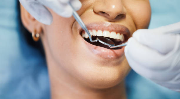 Best Emergency Treatment for Toothache in Clayton, OH