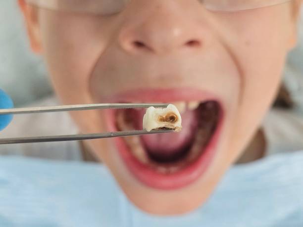 Best Emergency Treatment for Toothache in Clayton, OH